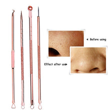 Load image into Gallery viewer, Rose Gold Acne, Blackhead, Pimple Removal Tools