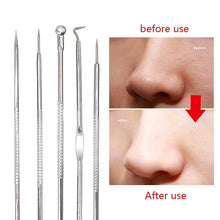 Load image into Gallery viewer, Rose Gold Acne, Blackhead, Pimple Removal Tools