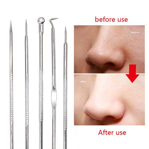 Rose Gold Acne, Blackhead, Pimple Removal Tools