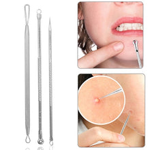 Load image into Gallery viewer, Rose Gold Acne, Blackhead, Pimple Removal Tools