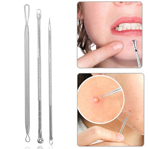 Rose Gold Acne, Blackhead, Pimple Removal Tools