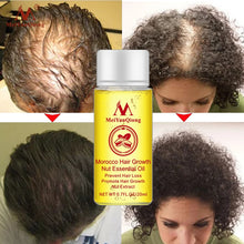 Load image into Gallery viewer, Morocco Hair Growth Essential Oil