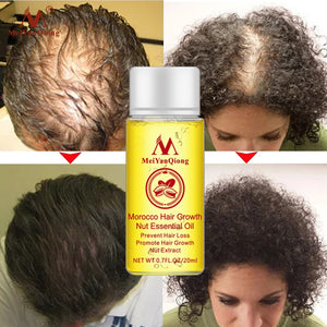 Morocco Hair Growth Essential Oil