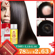 Load image into Gallery viewer, Morocco Hair Growth Essential Oil